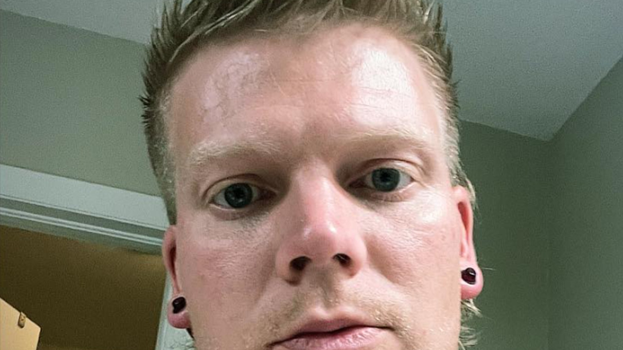 Blake Garrett's Cause of Death Confirmed as Fentanyl Overdose